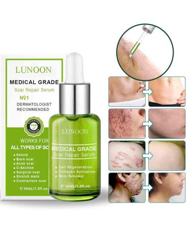 Goopgen Advanced Scar Repair Serum 30ml - 100% Natural Treatment for All Types of Scars (2 PCS) - Buy Online on GoSupps.com