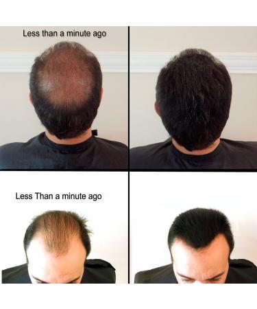 Samson Keratin Hair Loss Fibers - Black 25g Refillable Container Hair Loss Concealer - Made in USA - Buy Online on GoSupps.com