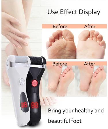 Jooayou Electric Foot File for Hard Skin - Rechargeable Callus Remover with 3 Rollers & 10-in-1 Foot Scraper Set - Buy Online on GoSupps.com