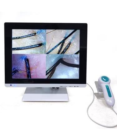 Scalp Detector Skin Diagnosis Hair Analyzer 15 Inch Screen Digital Skin Detector Moisture Tester Hair Skin Analyzer Machine for Home Beauty Salon Spa - Buy Online on GoSupps.com