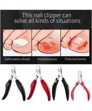 SJLS Stainless Steel Toenail Ingrown Nail Art Nipper Scissors Paronychia Dead Skin Remover Trimming Nail Clipper Pedicure Tool (Color : 07) Black blue - Buy Online on GoSupps.com
