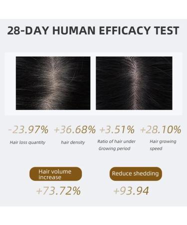Peigne lectrique anti-chute de cheveux rouge et bleu lumi re soin cuir chevelu massage pousse cheveux peigne infrarouge coiffeur - Buy Online on GoSupps.com