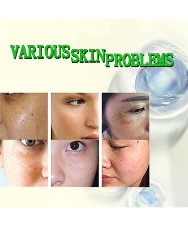 Crema para Aclarar las Axilas y Partes Intimas Para Piel Entrepierna Manchas Codos Piernas Zonas ntimas Cara Axilas Rodillas Cuello 50G (1 bottles loci n de cuidado de axilas y partes intimas) - Buy Online on GoSupps.com
