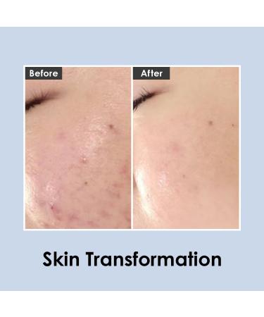 MEDI-PEEL Centella Mezzo Cream 1.01 fl oz - Cica Moisturizing Cream for Skin Breakouts & Sensitive Skin | Korean Skincare Hydration & Repair for All Skin Types - Buy Online on GoSupps.com