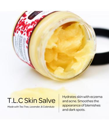 Red Rose Naturals TLC Skin Salve - 100% All Natural Balm for Eczema, Psoriasis, Acne, Dark Spots, Rashes, and Dry Skin - Buy Online on GoSupps.com