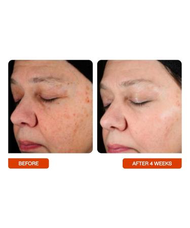 BeautyStat Universal Vitamin C Serum - 1 Oz 2 Pack - Buy Online on GoSupps.com