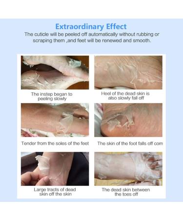 Onkessy Foot Peel Mask - Exfoliating Dead Skin Feet Repair Treatment - For Men and Women - Pedicure Spa - 1 Pair - Buy Online on GoSupps.com