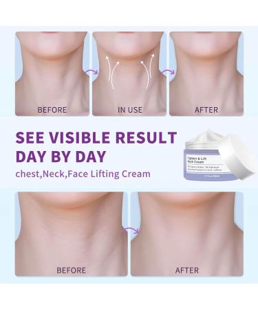 Neck Firming Cream with Hyaluronic Acid - Tighten Lift & Hydrate for Youthful Skin | 1.7 oz - Buy Online on GoSupps.com