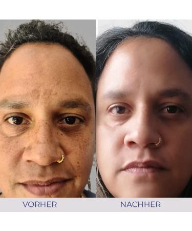 Omnimedica Hydro Lotion 3-in-1 | Moisturizing & Anti-Age Formula with Swiss Patent | OM24 Green Extract | 200ml - International Shipping Available - Buy Online on GoSupps.com