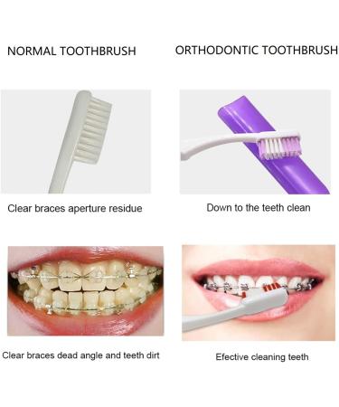 Portable Orthodontic Care Kit for Braces - Dental Travel Kit with Interdental Brush, Wax, Floss - Purple (8 Pcs) - Buy Online on GoSupps.com