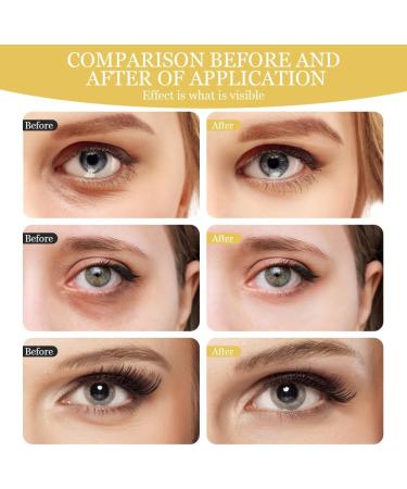 LOPHE Under Eye Patches Collagen 24k Gold Under Eye Masks for Puffy Eyes Moisturizing Under Eye Gel Pads for Dark Circles Bag Lines Improving Firm Hydrate Under Eye Patches (30 Pairs) - Buy Online on GoSupps.com