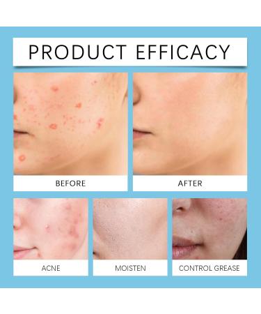 Acne Repair Face Cream - Moisturiser Face Women - Face Moisturizer for Women - Deeply Nourishes Skin - Skin Lightening Cream - Light Texture and Easy Absorption - Buy Online on GoSupps.com