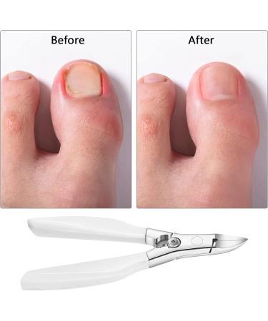 Professional Toe Nail Clipper for Ingrown and Thick Toenails - Stainless Steel Podiatrist Nipper with Sharp Blades, Easy Grip Handle, and Lock - Seniors' Pedicure Tool - Buy Online on GoSupps.com