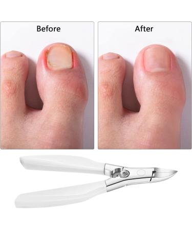 Premium Toenails Trimmer & Nail Snaps for Thick Ingrown Toenails - Stainless Steel Pedicure Cutter with Slip-Resistant Handle - Buy Online on GoSupps.com