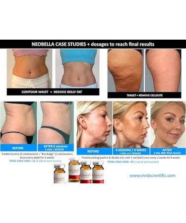 NEOSCULPT Fat Dissolving Serum (5 vials x 8mL) | Target and Treat Stubborn Cellulite & Fat on Body & Face | Booster to Accelerate Results Included | Order Includes Everything Seen in Photos - Buy Online on GoSupps.com