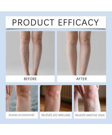  VKaoess Soothing and moisturizing leg cream gel-cream for dry skin light and non-greasy moisturizing care daily moisturizing cream helps maintain skin hydration (3 boxes) - Buy Online on GoSupps.com