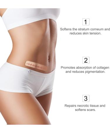 Professional Silicone Scar Tape - Soft Scar Sheets for Acne, Keloid, Burns - 1.6 x 120 Roll - Buy Online on GoSupps.com