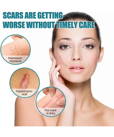 Silicone Scar Tape Roll - Self-Adhesive Patch for Acne Scars and Skin Repair (3pcs) - Buy Online on GoSupps.com