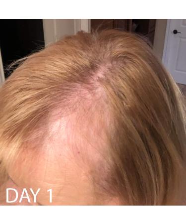 Biotin Hair Growth Conditioner - High Potency Anti Hair Loss Treatment with Vitamins E, A, and C - 8.5 Ounce - Buy Online on GoSupps.com