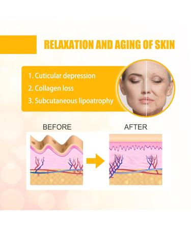 Smile Line Patches - 10pcs Collagen Hydrating Masks for Anti-Aging Smoothing Laugh Lines & Wrinkles - Buy Online on GoSupps.com