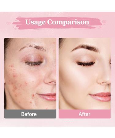 Turmeric Cleansing Pads (120 PCS) - Kojic Acid & Compressed Facial Sponges for Deep Cleaning & Exfoliating | New 2024 - Buy Online on GoSupps.com