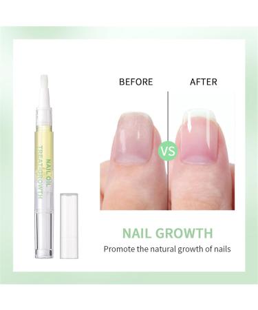 Ruarby Nail Oil Growth Cuticle Oil Moisturize Strengthen Nails Care for Damaged Nails and Cuticle Repair Cuticle Oil Nail Treat - Buy Online on GoSupps.com