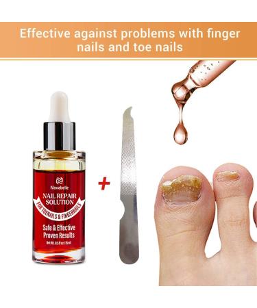 Extra Strength Toe Nail Fungus Treatment - Nail Repair Solution for Damaged Nails - Buy Online on GoSupps.com