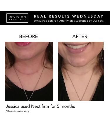 Revision Skincare Nectifirm Tube 8 oz - Advanced Neck Firming Cream - Buy Online on GoSupps.com