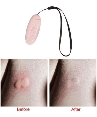 Harayaa Sting & Bite Relief Pen - Portable Antipruritic Device for Men & Women - Outdoor Skin Itch Relief Tool in Pink - Buy Online on GoSupps.com