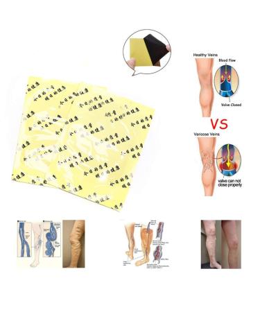18Pcs Pat Varicose Veins Treatment Plasters - Herbal Medicine for Spider Veins & Vasculitis - Effective Chinese Remedies - Buy Online on GoSupps.com