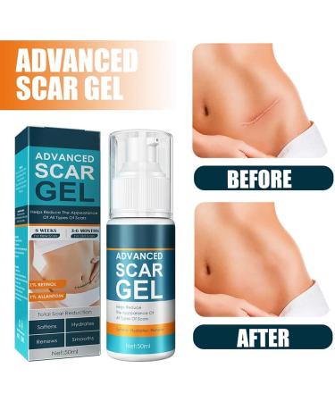 Scar Removal Cream Gel - Natural Extract for Brightening & Reducing Surgical Scars - Buy Online on GoSupps.com