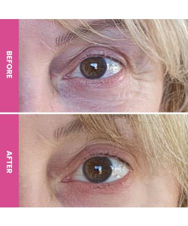 PrimeEyes Hydrate Under Eye Cream for Mature Women | Anti-Aging Dark Circle Treatment & Wrinkle Repair - Soft Glowing Under Eyes - Buy Online on GoSupps.com