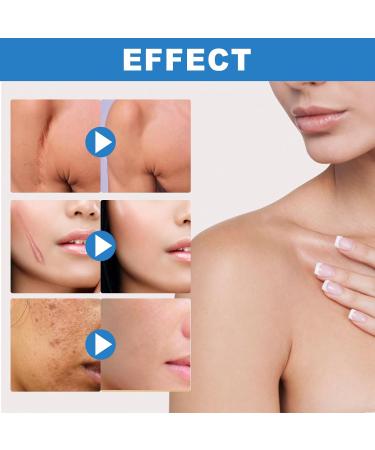 Silicone Scar Gel - Scar Removal Cream - 30g Scar Cream - Scar Removal and Soothing Cream for Surgical Scars Acne Scars C-Section Burns Stretch Marks - Effective for Old and New Scar - Buy Online on GoSupps.com