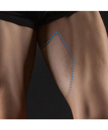Protection Anti-Frottements pour la Face Interne des Cuisses - Transparentes Imperm ables 5 Bandes Anti-Frottement Cuisses Bandages Adh sifs Jambes Sport Ext rieur Coureurs Jeans Anti-Affaissement - Buy Online on GoSupps.com