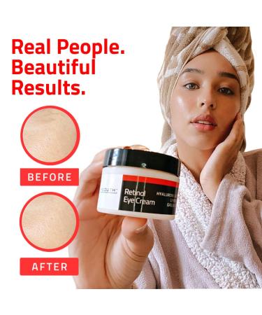 Yeouth Retinol Eye Cream with Hyaluronic Acid - Dark Circle and Puffiness Treatment - Buy Online on GoSupps.com