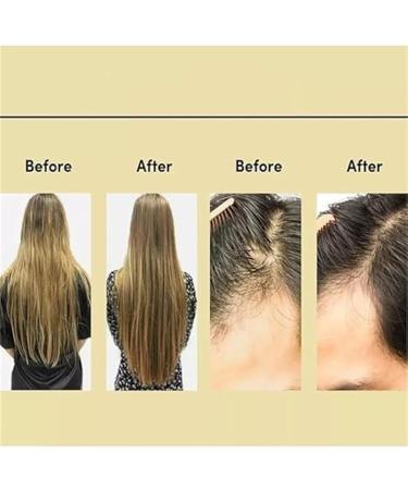  Yanobia Hair Growth Oil Growth & Reset Oil Strengthen Hair Roots for Dry Damaged Hair and Fine Hair Growth Hair Care - Buy Online on GoSupps.com