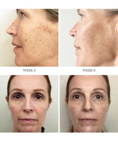 City Beauty Advanced Retinol System - Dual Anti-Aging Face Serums with Retinol & Vitamin C - Firm Smooth & Brighten Skin - Target Wrinkles Dark Spots & Sagging - Cruelty-Free Skincare - Buy Online on GoSupps.com