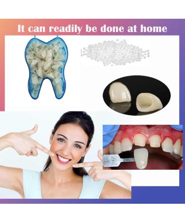 Temporary Crowns for Damaged Teeth - Realistic Oral Care 50PCS Multiple Sizes for Front Teeth - International Shipping - Buy Online on GoSupps.com