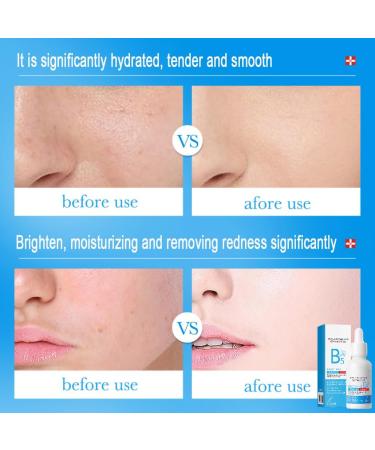 Hyaluronic Acid Face Serum Ultra Pure Hyaluronic Acid Moisturising Serum Boosted With Vitamin B5 Shrink Pores & Smooth Fine Lines Instant Anti Wrinkle Serum Tightening & Improve Dull Skin - Buy Online on GoSupps.com