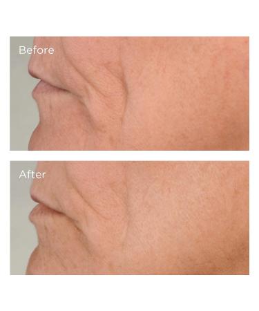 Perricone MD High Potency Classics Firming Serum 2 oz | Growth Factor Lifting Serum - Buy Online on GoSupps.com