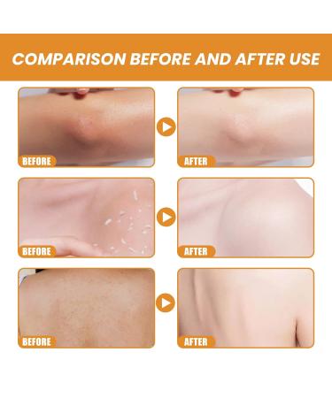 Deep Cleaning Exfoliating Gel for Face & Body | Gentle Peeling Gel with Salicylic Acid for Whitening & Brightening | Removes Dead Skin & Improves Skin Texture - Buy Online on GoSupps.com