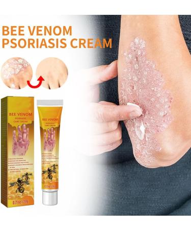 RJDJ Bee Venom Psoriasis Treatment Cream - Professional New Zealand Formula for All Skin Types (5PC) - Buy Online on GoSupps.com