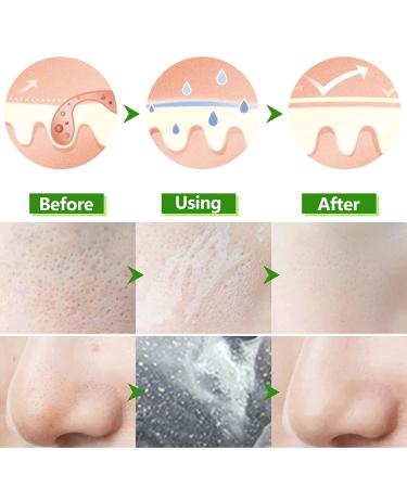 Aloe Vera Peel Off Blackhead Remover Mask - Whitehead Removal & Oil Control - 2 Piece Set - Buy Online on GoSupps.com