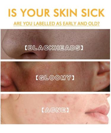 Juelreou 2024 Anti-Blemish & Anti-Aging Tear-Off Mask | Beautykomi Skin Rejuvenation Facial for Moisturizing & Pore Cleansing (2 Pack) - Shop Internationally - Buy Online on GoSupps.com