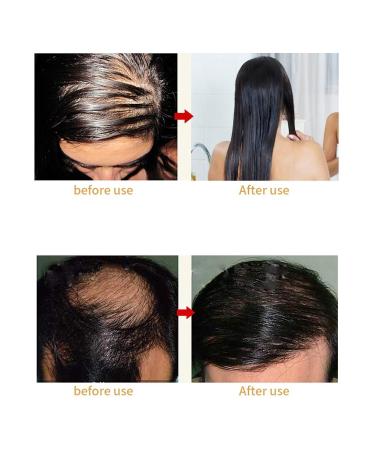 Laser Massage Comb for Hair Growth | Prevent Hair Loss & Rejuvenate with Infrared Therapy - Buy Online on GoSupps.com