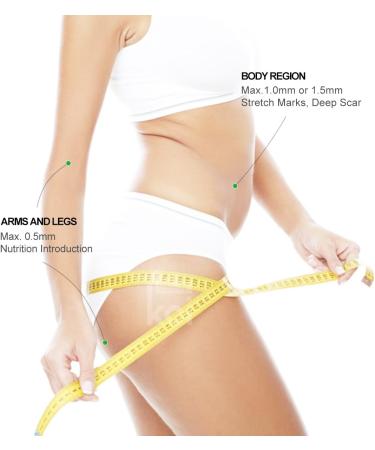 Koi Beauty 3 in 1 Derma Roller 0.3mm with 1200 Titanium Needles - Microneedling Roller for Body - Buy Online on GoSupps.com
