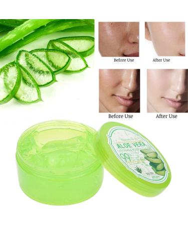 300g Aloe Vera Gel - Moisturizing Natural Care for Face & Body | Soothes Dry Skin & Sunburn - Buy Online on GoSupps.com