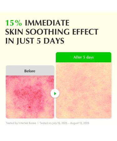 EQQUALBERRY Aloe PDRN Calming Smoothie Serum Soothing Korean Skin Care for Sensitive Skin Cica & Aloe for Repair Hydrating & Radiant Glow Non-Comedogenic (1.01oz / 30ml) Pack of 2 - Buy Online on GoSupps.com