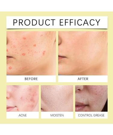 JOYVOIDX Coenzyme Q10 & Collagen Jelly Face Cream Deeply Nourishing Anti-Aging Daily Moisturizer with Tocopherol (Vitamin E) Hydrating & Firming Formula for Women & Men 1.76 oz - Buy Online on GoSupps.com