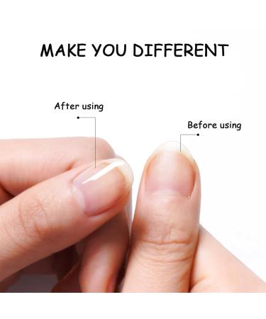 Rosarden Cuticle Oil Pen Set for Nail Nutrition & Revitalization - 2PCS Nail Care Set for Nourishing, Softening, & Moisturizing Nails - Buy Online on GoSupps.com